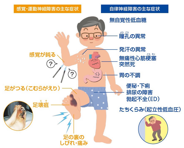 男性の糖尿病の症状